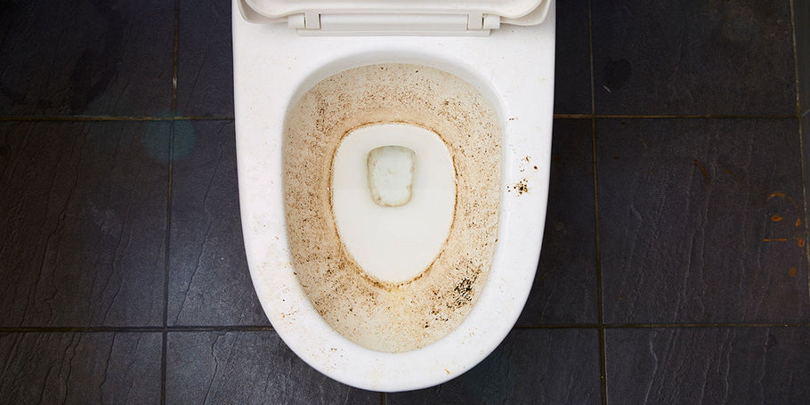 How To Clean Nasty Toilet Bowl Stains Fast and Easy